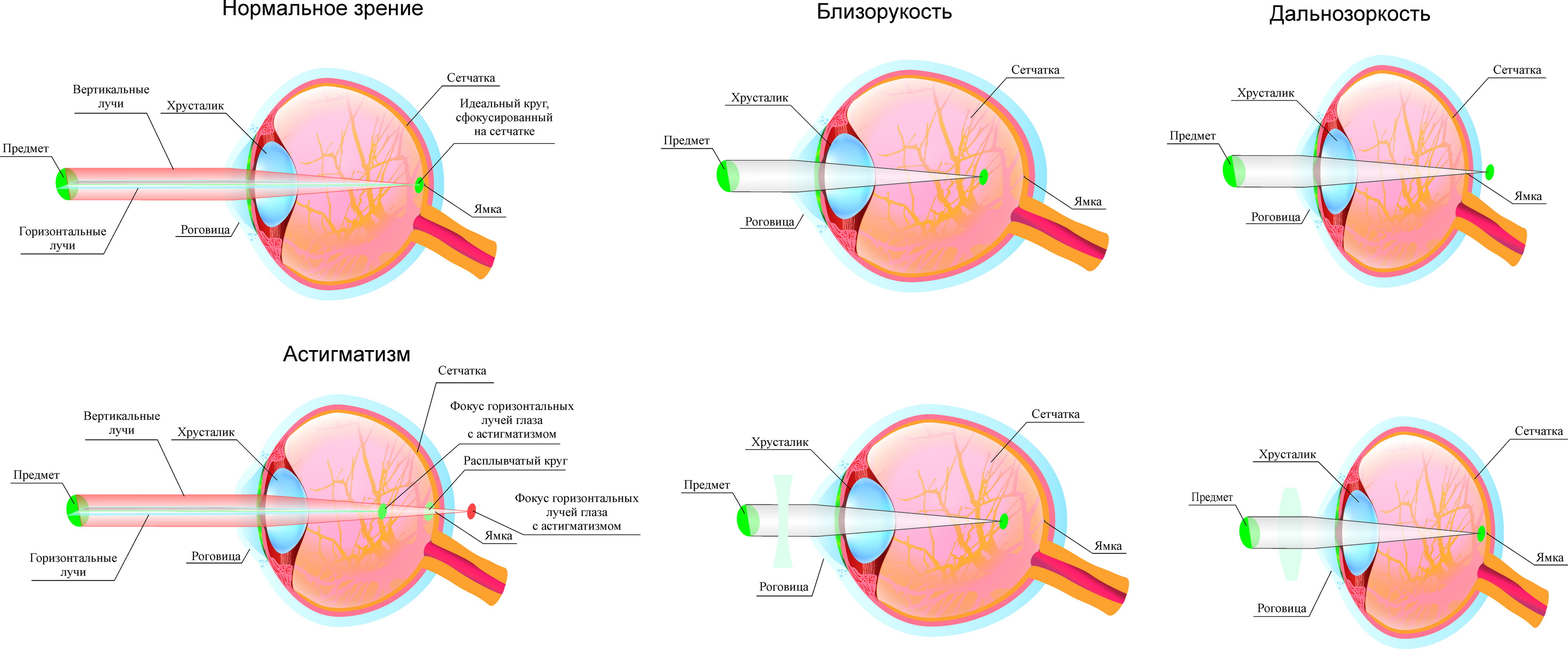 Плакат "Глаза"