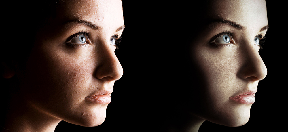 Ретушь кожи